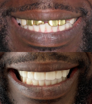 transformation-image1