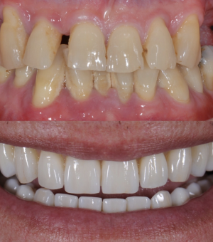 transformation-image4